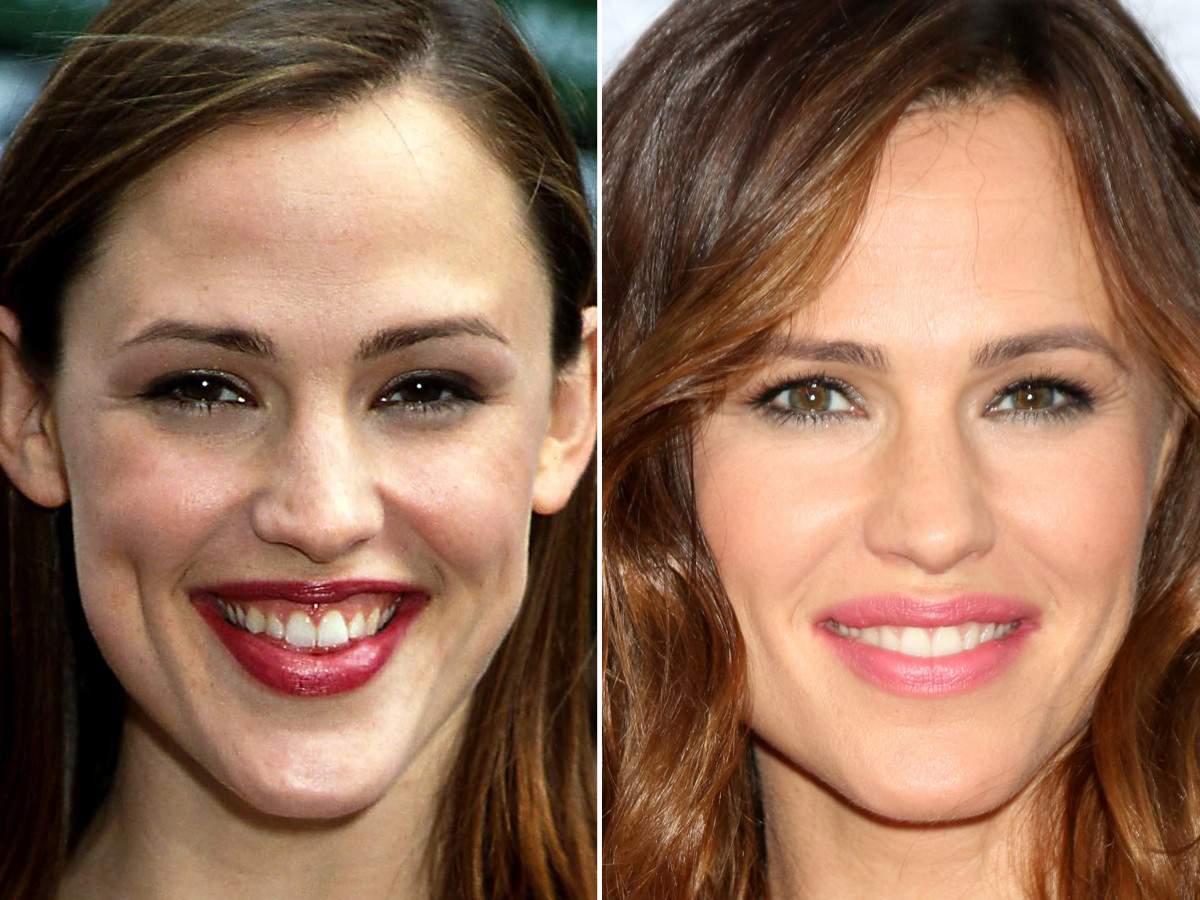 Jennifer Garner Before and After - The Glow Memo