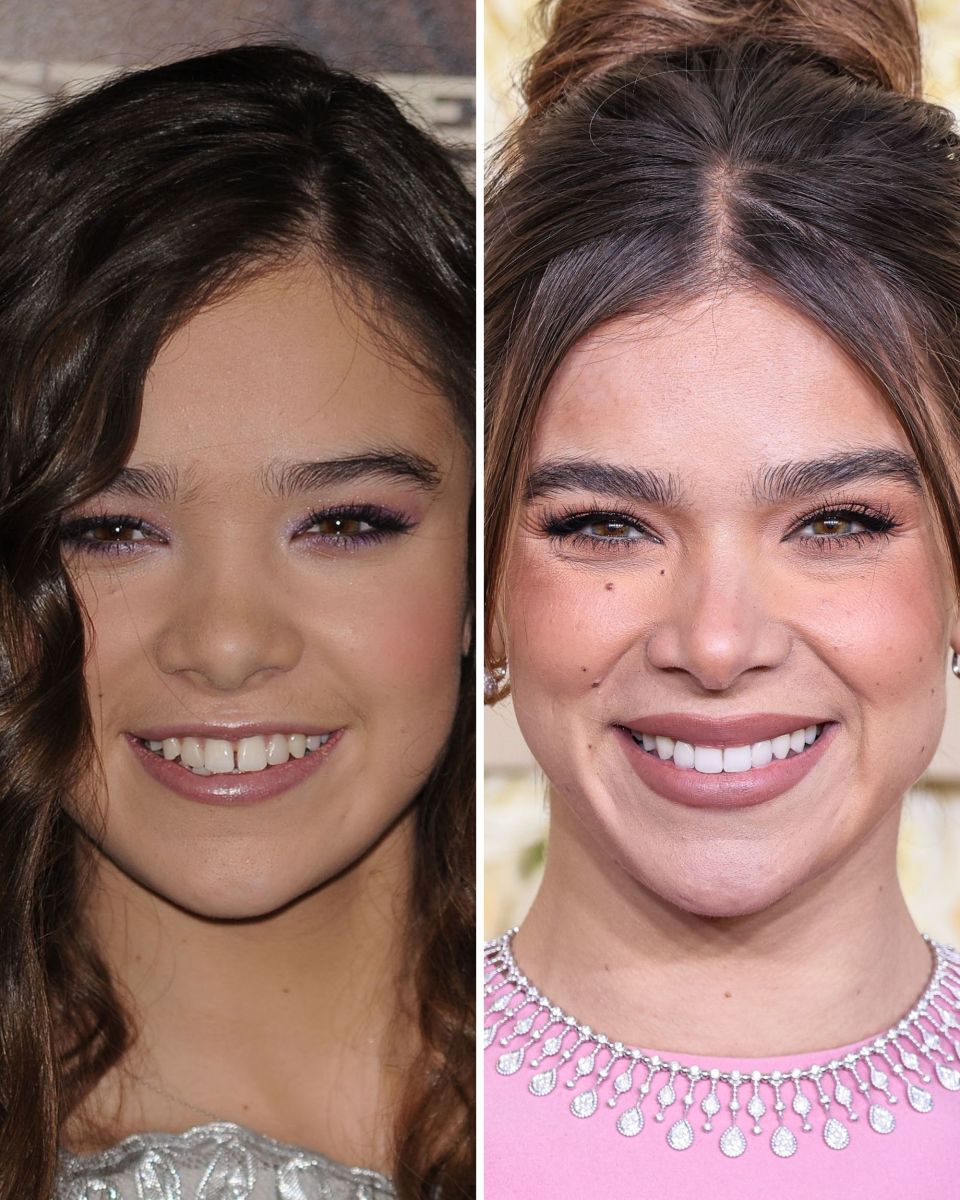 Hailee Steinfeld Before and After: From 2010 to 2024 - The Glow Memo