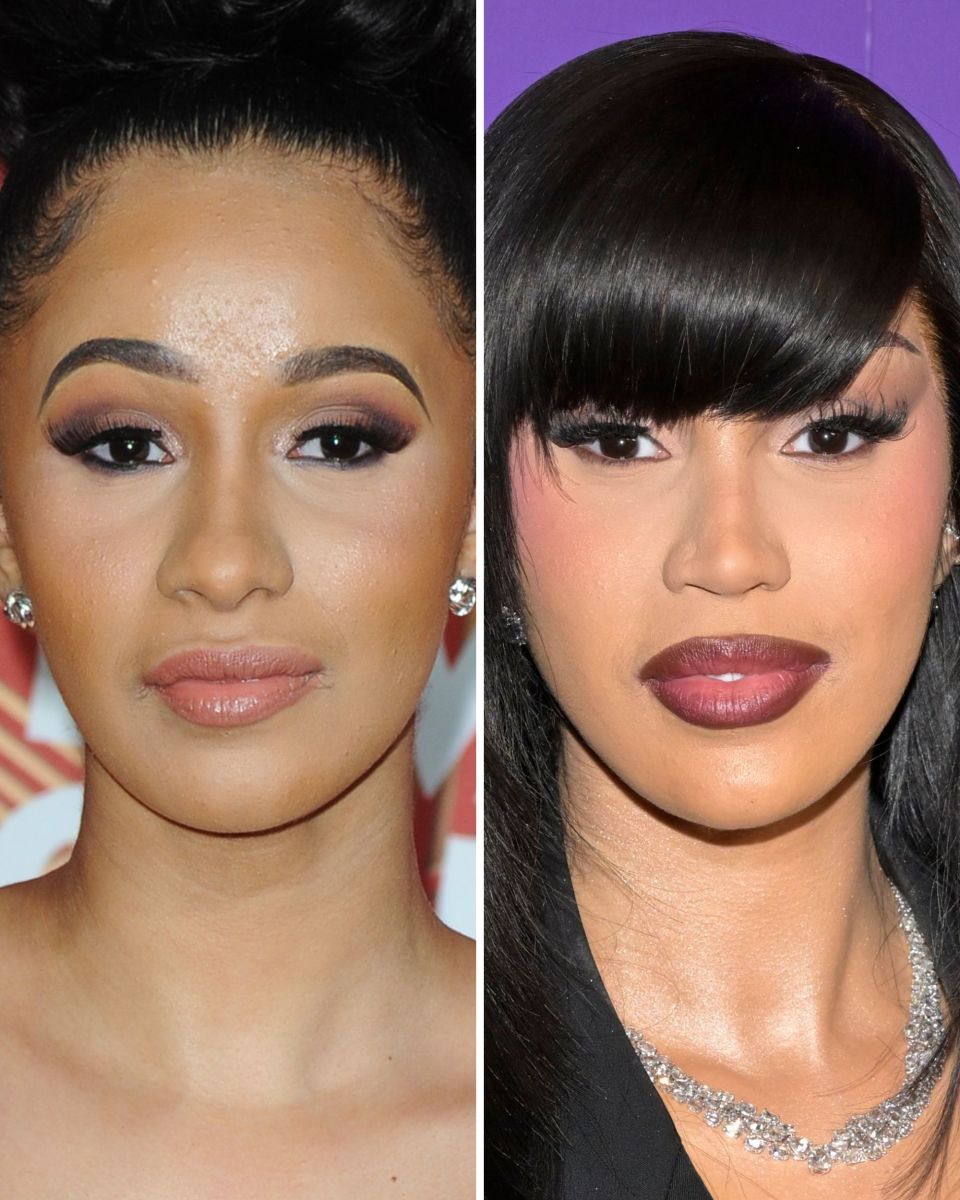 Cardi B Before And After: From 2016 To 2024 - The Glow Memo