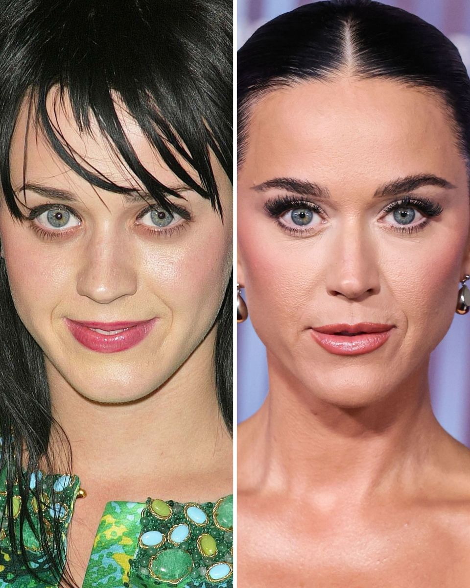 Katy Perry Before and After: From 2000 to 2024 - The Glow Memo