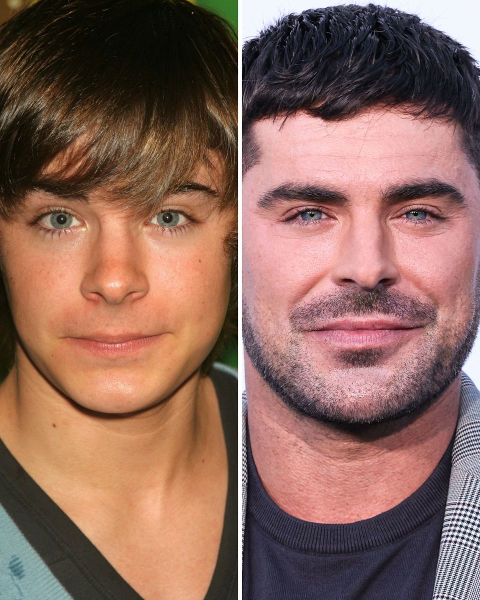 Zac Efron Before and After: From  to  - The Glow Memo