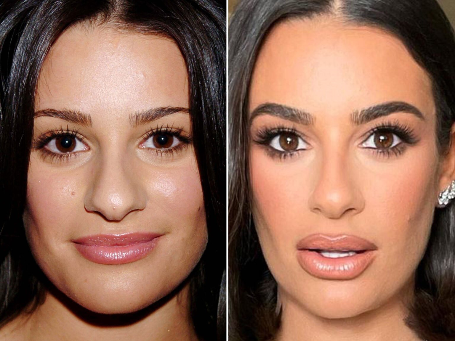Lea Michele before and after comparison showing her facial changes over the years