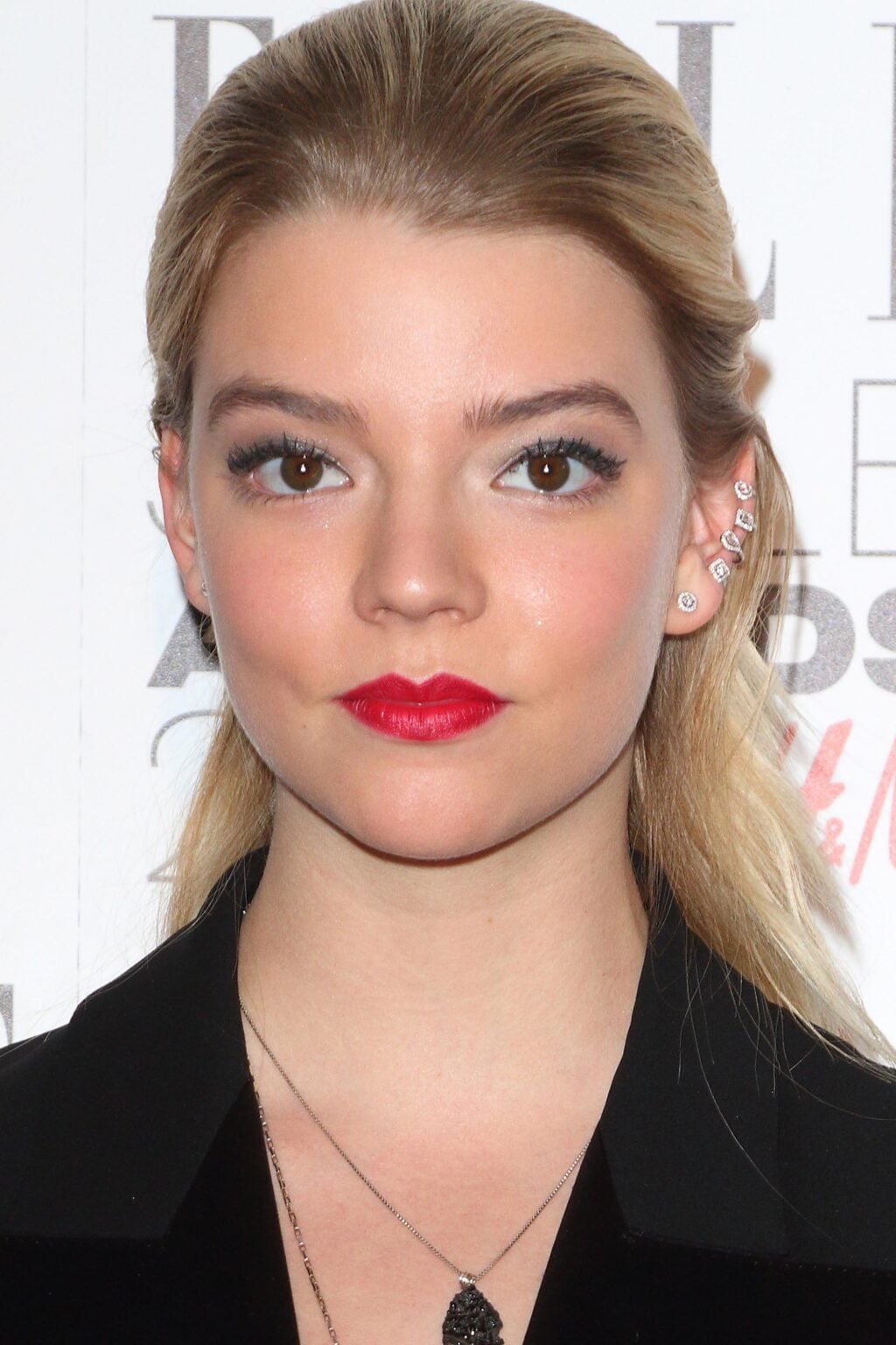 Anya Taylor-Joy Before and After: Plastic Surgery Rumors