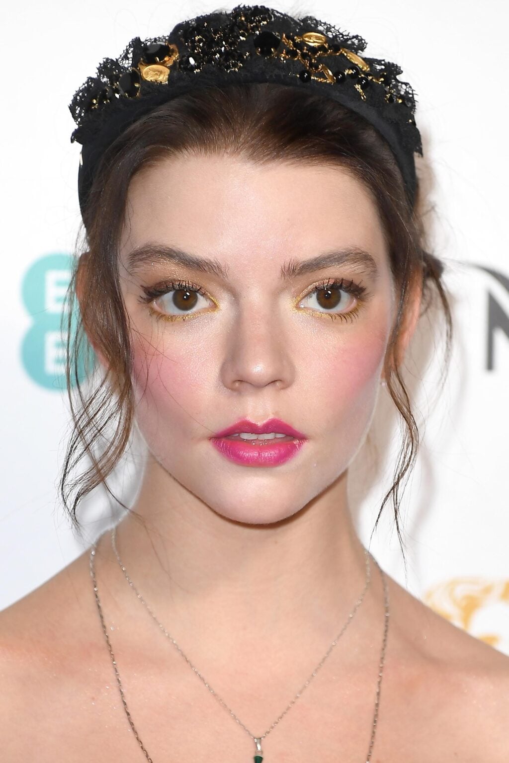 Anya Taylor-Joy Before and After: Plastic Surgery Rumors