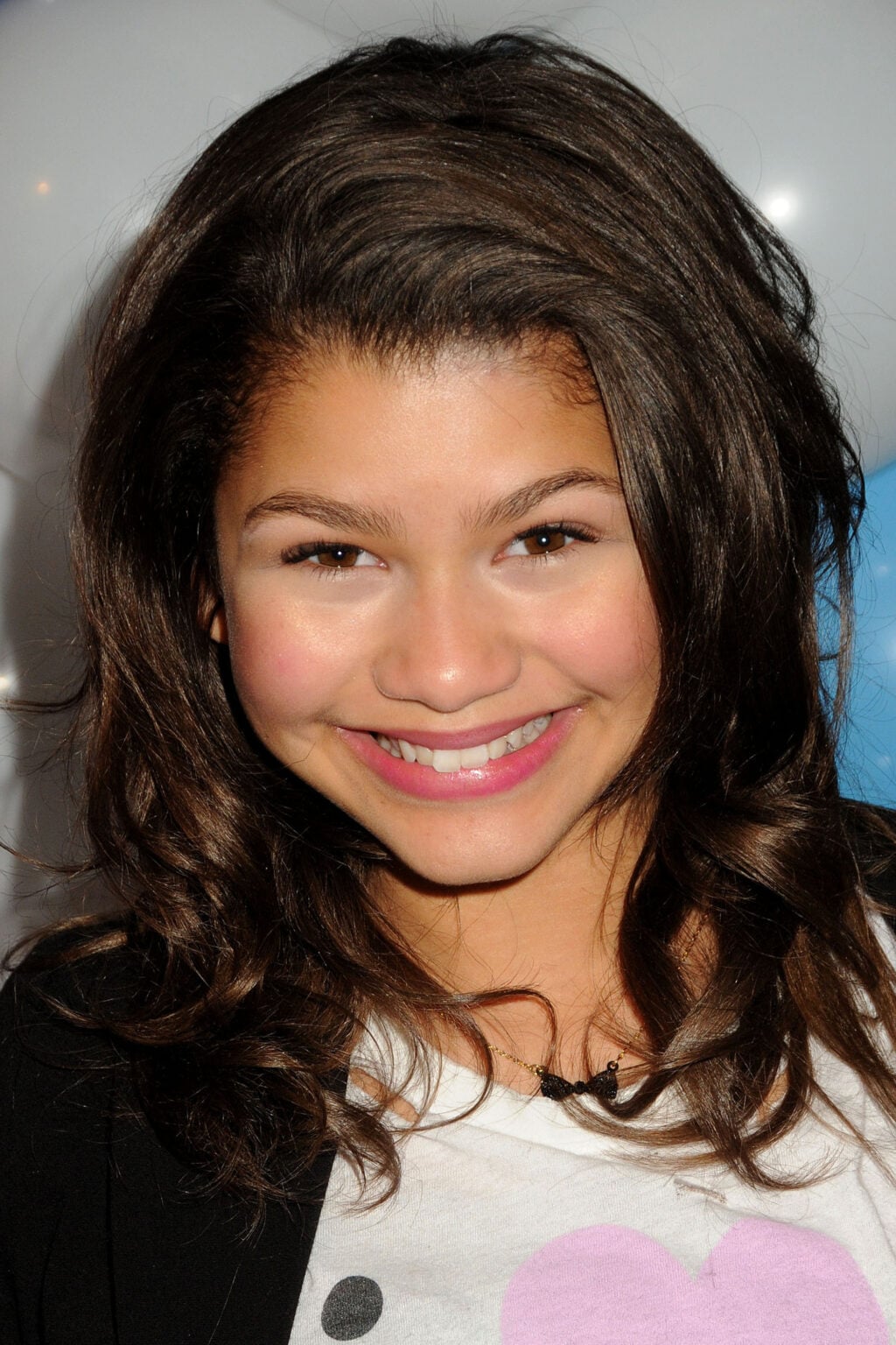 Zendaya Before and After: Plastic Surgery Rumors
